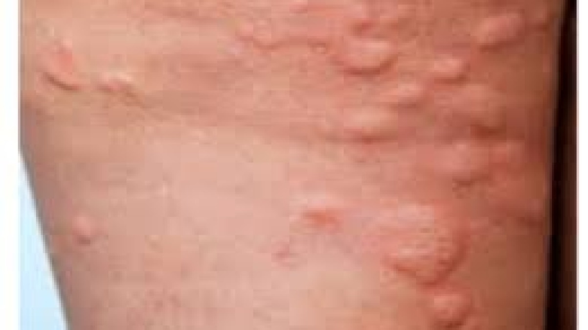 List of the best Skin and Dermatologist in Rajshahi.