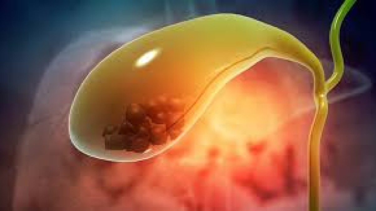 Best gallbladder Surgeon in Dhaka.