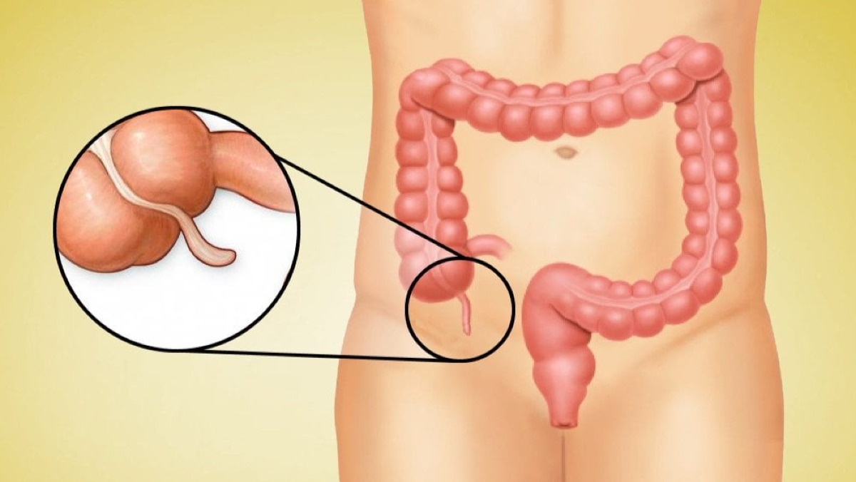 Best Appendix Specialist Doctors in Dhaka, Bangladesh
